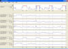 Screenshot of PRANA Profiler: Sleep EEG bands